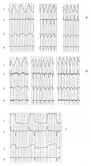 munck202.jpg (37447 octets)