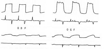 munck203.jpg (7436 octets)